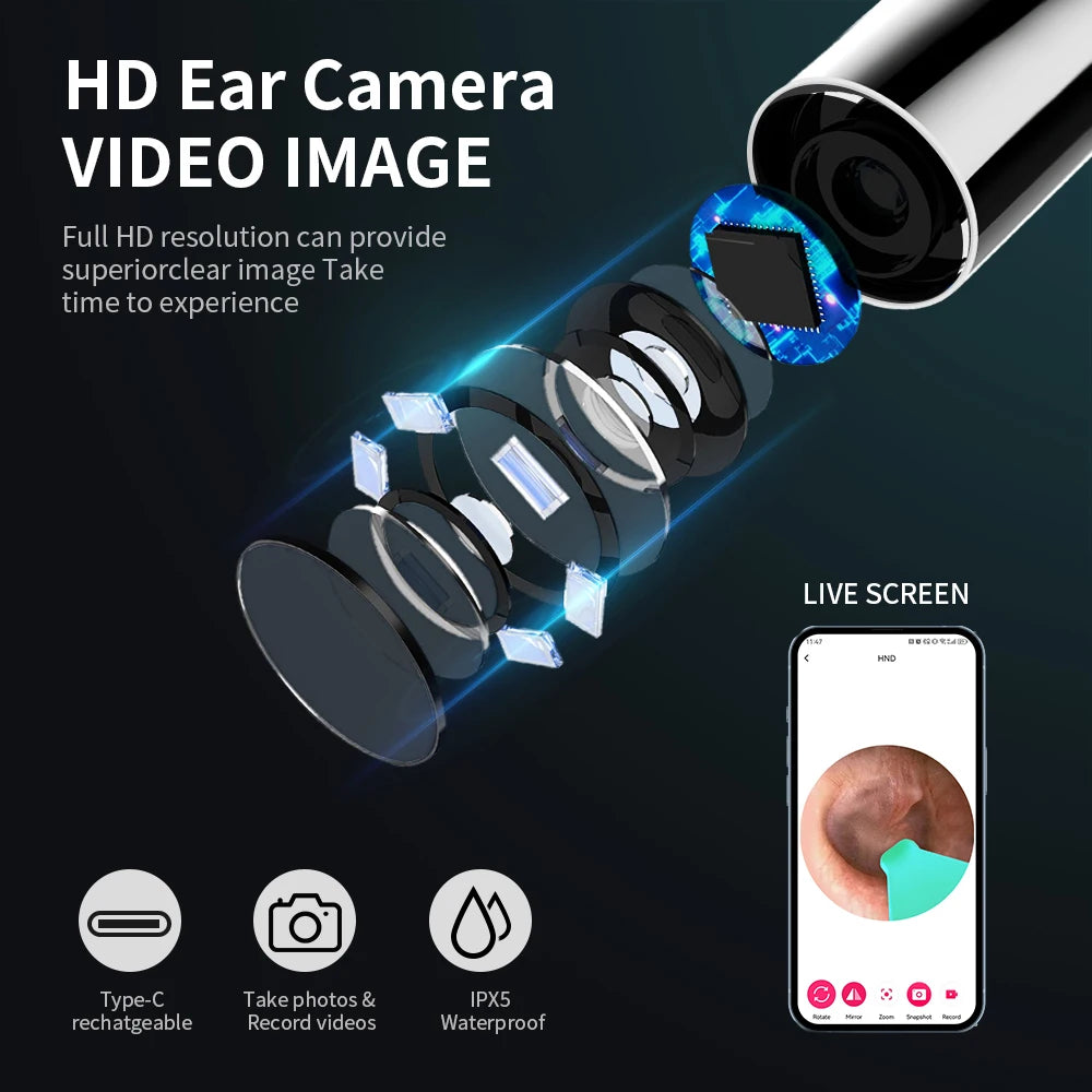 👂 Otoscope Connecté avec Caméra HD – Nettoyeur d’Oreilles Intelligent