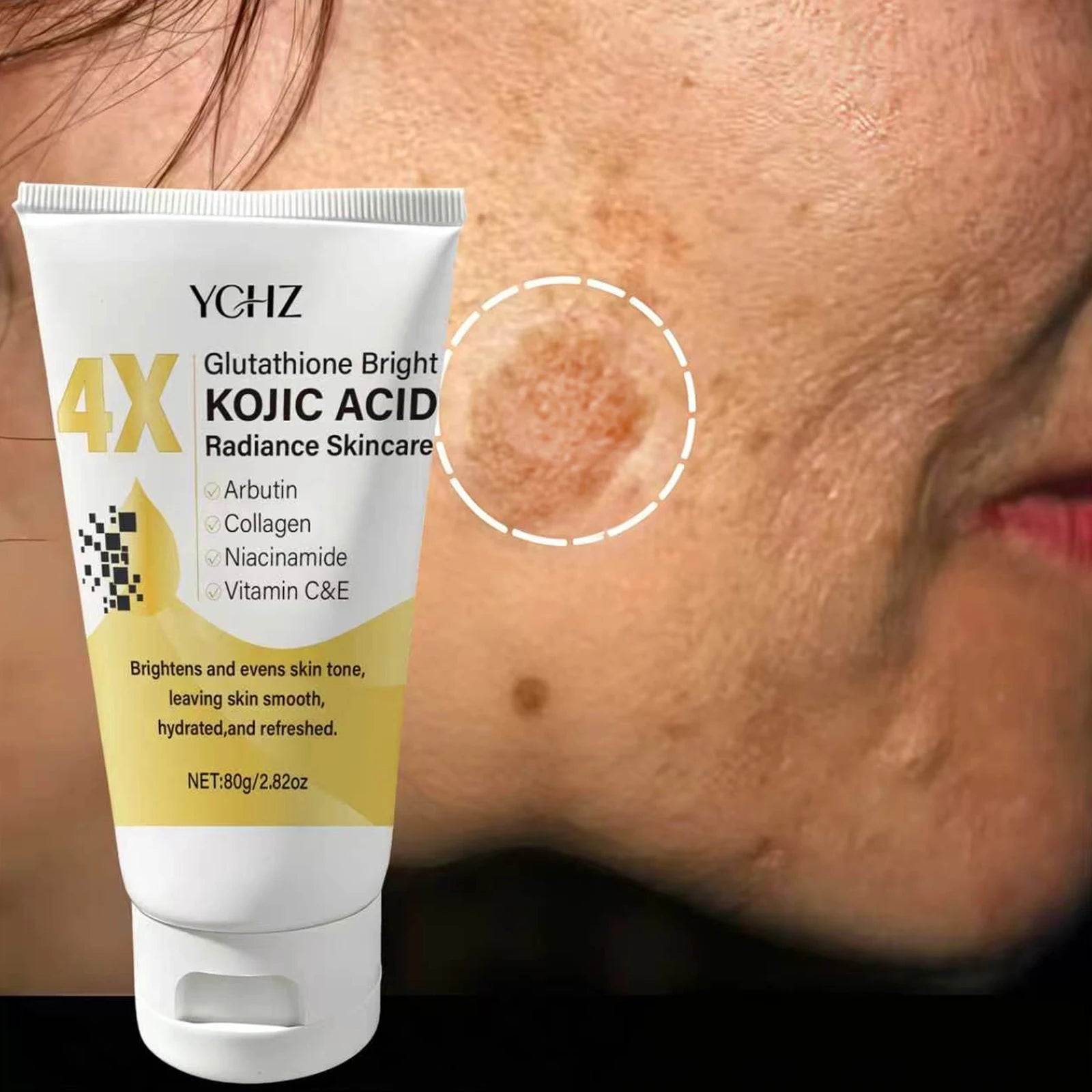 Crème Correctrice à l’Acide Kojique – Anti-Taches, Hydratation & Éclat