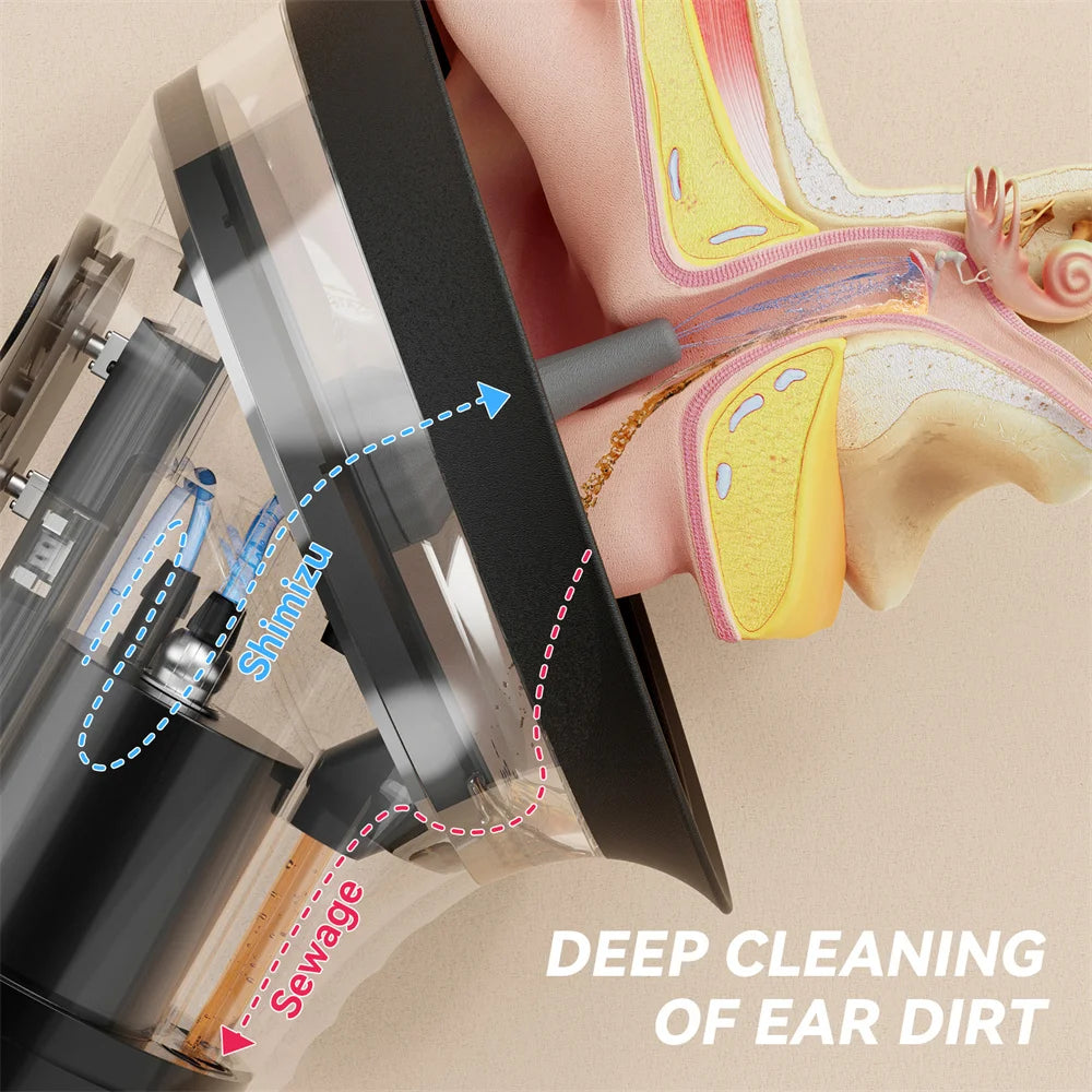 HydroClean Prestige™ – Nettoyeur d’Oreilles Électrique Haute Performance | Nettoyage Professionnel, Doux et Sécurisé ✨