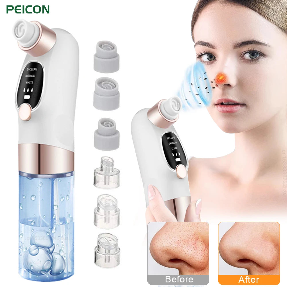 PoreVac Pro™ – Nettoyeur de Pores et Éliminateur de Points Noirs