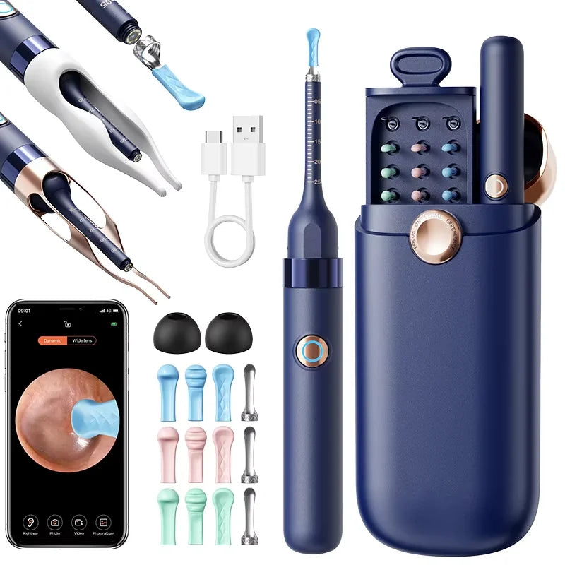 EarVision Pro™ – Nettoyeur d’Oreilles Intelligent avec Caméra HD 800W