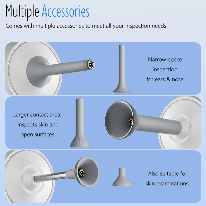 ✨ EarVision Elite™ – Otoscope Numérique HD 1080P avec Écran 1,38”, Caméra HD & 6 LED pour Nettoyage Précis des Oreilles