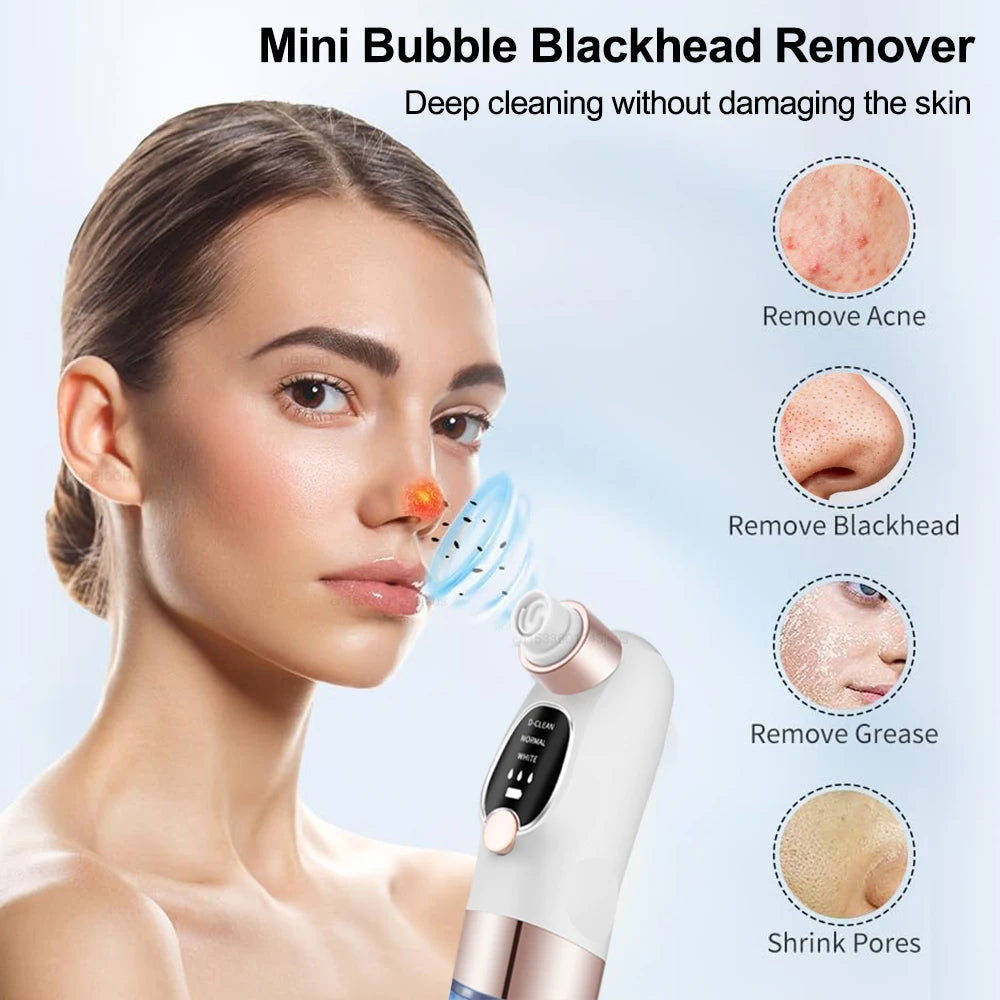 PoreVac Pro™ – Nettoyeur de Pores et Éliminateur de Points Noirs