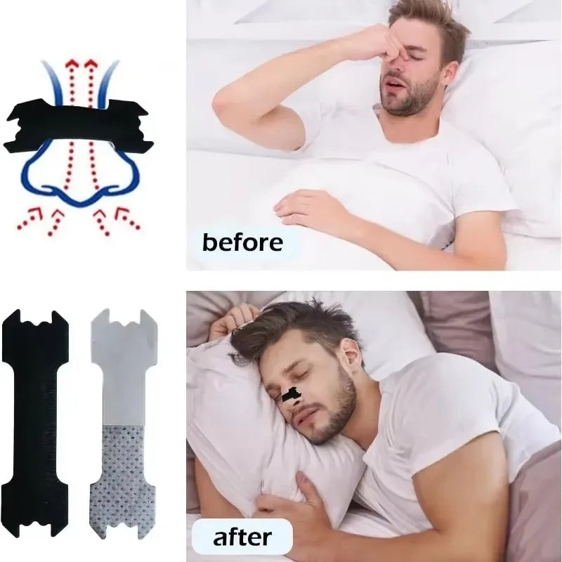 ⭐ Bandelettes Nasales Premium Anti-Ronflement – Respiration Optimisée & Sommeil Réparateur