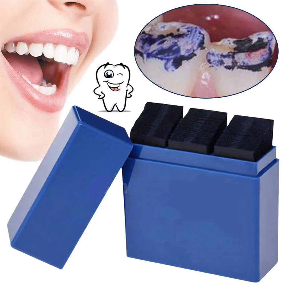 🦷 SmileCheck Pro™ – Papier Articulé Dentaire de Précision