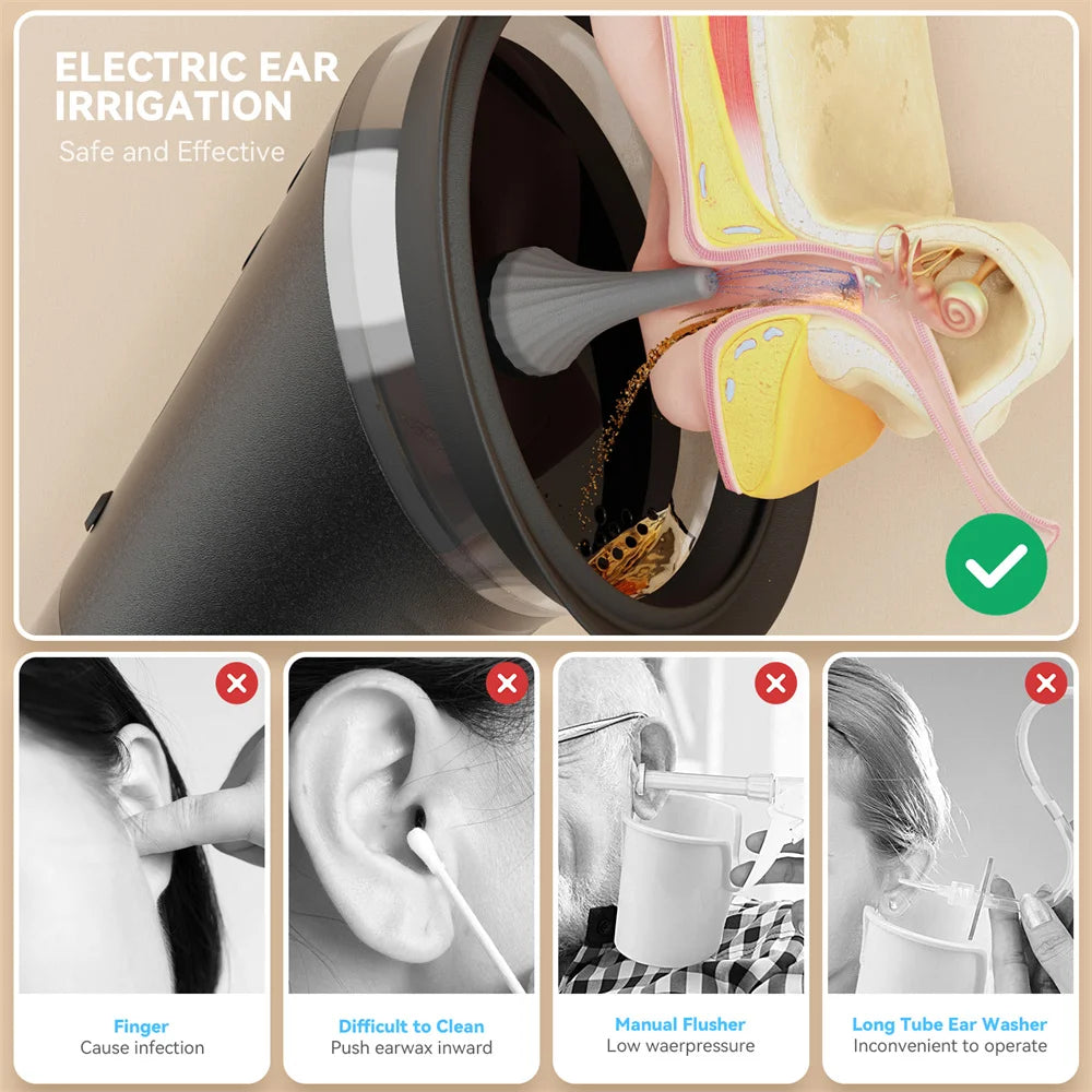 HydroClean Prestige™ – Nettoyeur d’Oreilles Électrique Haute Performance | Nettoyage Professionnel, Doux et Sécurisé ✨