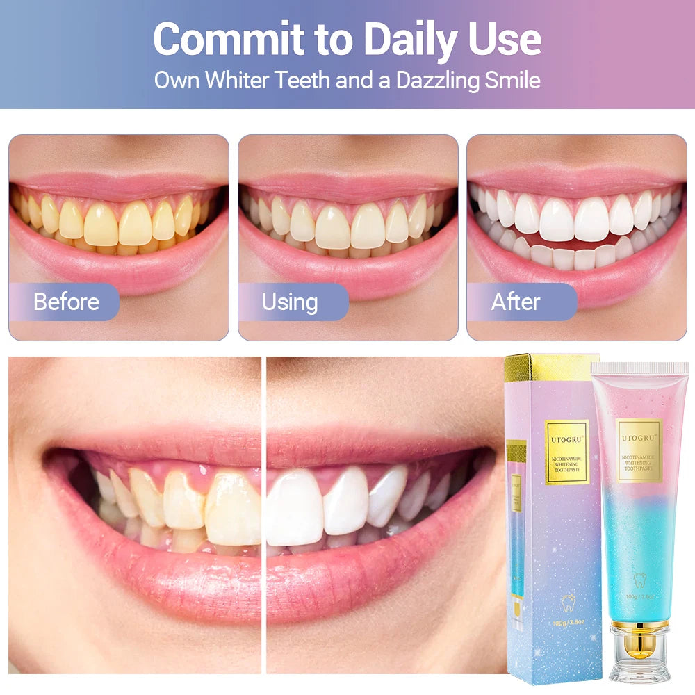 💎 Dentifrice Blanchissant Haute Performance – Révèle un Sourire Plus Blanc, Plus Propre & Plus Lumineux 🦷✨
