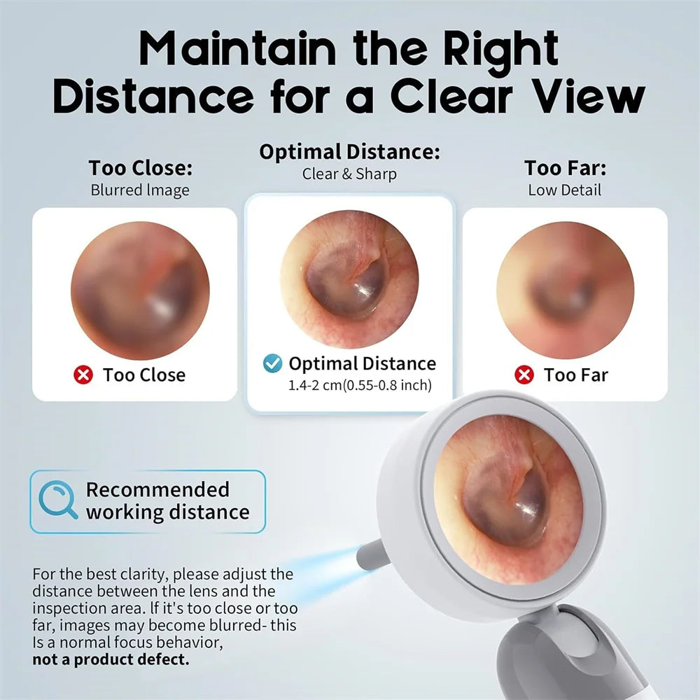 👂 EarVision Pro™ – Caméra HD de Nettoyage des Oreilles ✨