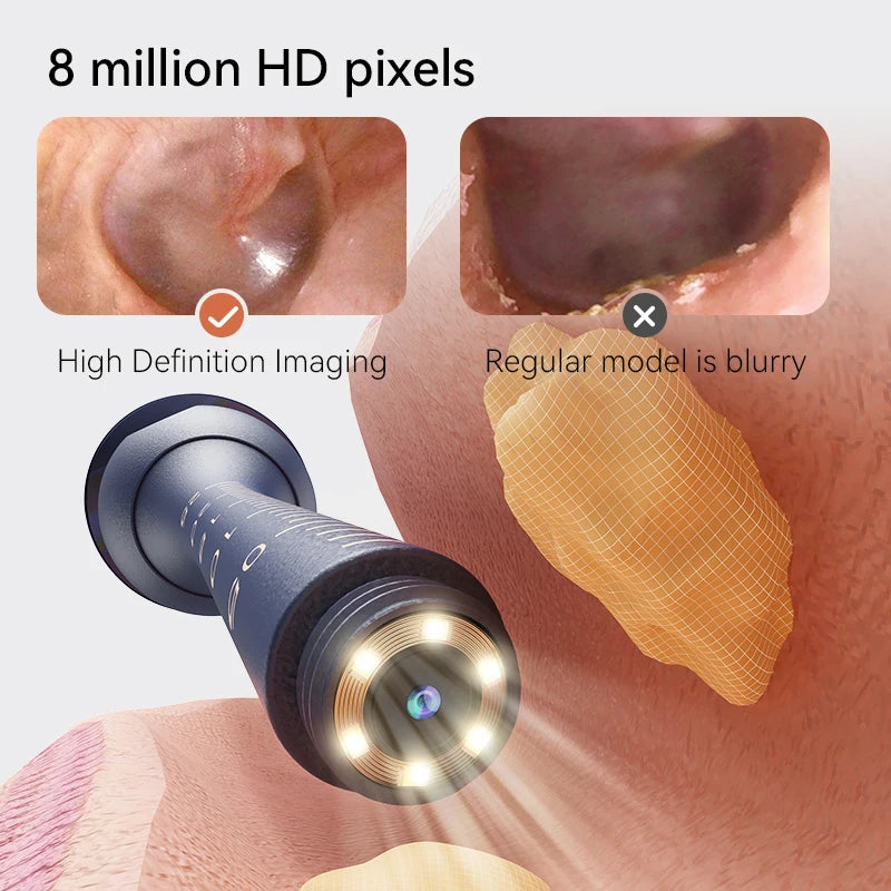 EarVision Pro™ – Nettoyeur d’Oreilles Intelligent avec Caméra HD 800W