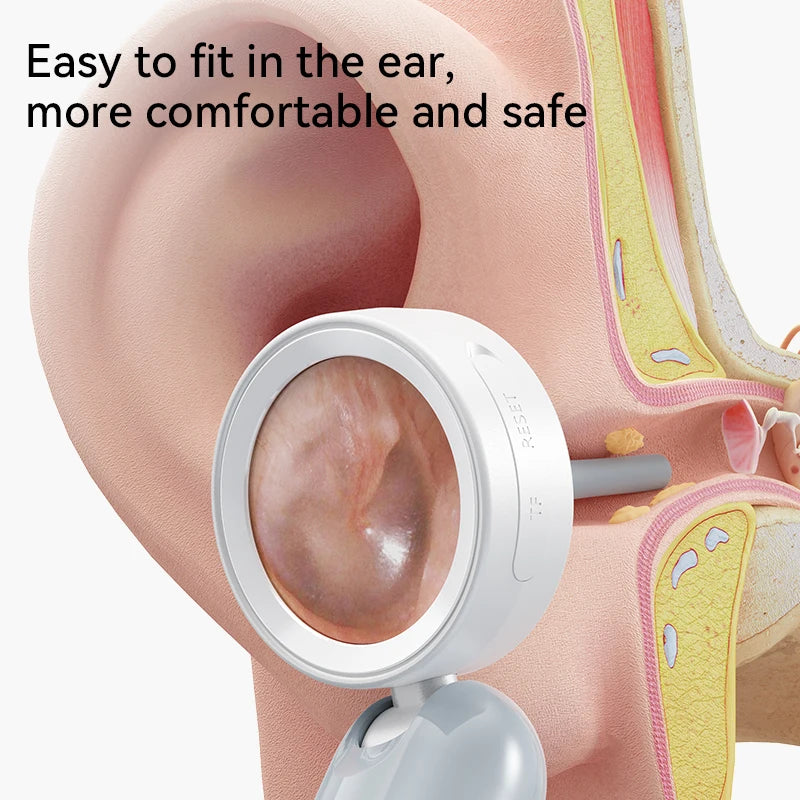 👂 EarVision Pro™ – Caméra HD de Nettoyage des Oreilles ✨