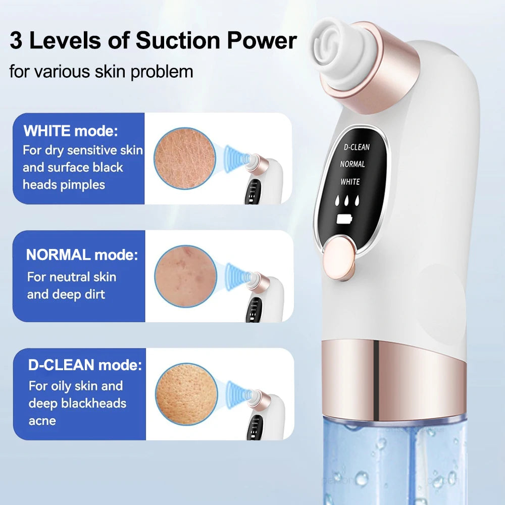 PoreVac Pro™ – Nettoyeur de Pores et Éliminateur de Points Noirs