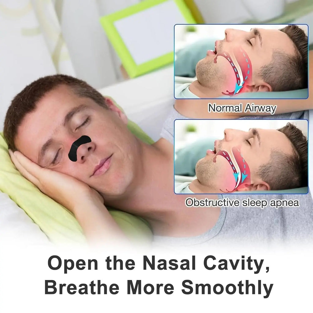 ⭐ Bandelettes Nasales Anti-Ronflement – Respiration Optimisée & Sommeil Réparateur