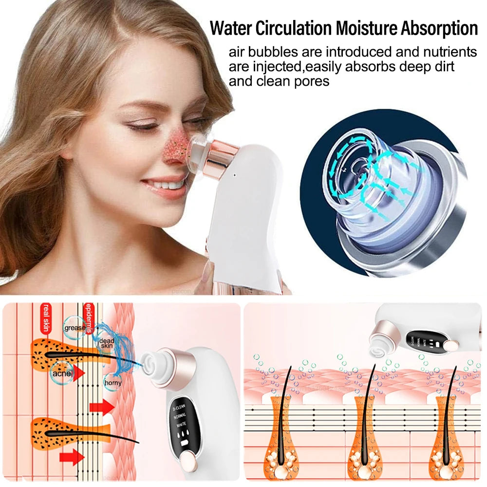 PoreVac Pro™ – Nettoyeur de Pores et Éliminateur de Points Noirs