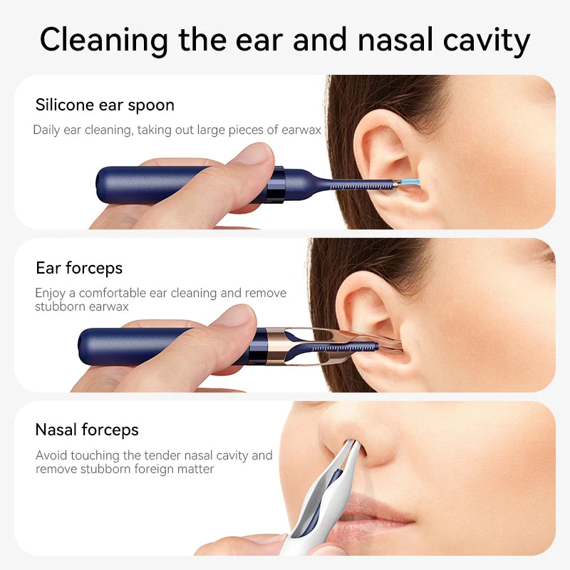 EarVision Pro™ – Nettoyeur d’Oreilles Intelligent avec Caméra HD 800W